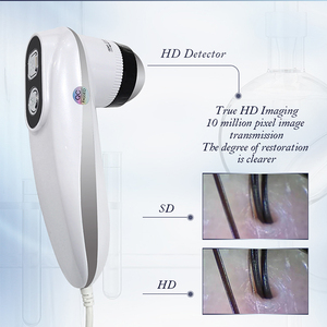 Sonda de Detección HD - Analizador de Cabello y Cuero Cabelludo SA-S15 de 10 Millones de Píxeles - Product Image 5