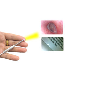 CXCW FOV68度3.9mmUSBインターフェースType-C mini 3 in 1 OV9734人間の耳に使用される医療用内視鏡検査 - Product Image 2