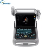 Gerçek Zamanlı Renkli Doppler Ultrason Sonografi Kardiyak Doppler Eko Tıbbi Ultrason Tarayıcı CU60B