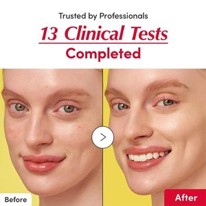 Suero Facial Líquido Iluminador y Blanqueador con Vitamina C, Niacinamida, Ceramida y Ácido Hialurónico, Cuidado de Manchas Oscuras, Hidratante, 30 ml - Product Image 5