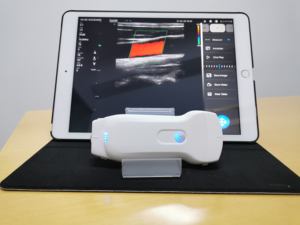 Minbrand marka prob 192 eleman 3 in 1 çift kafa kablosuz prob ultrason kablosuz renkli Doppler 3 in 1 prob - Product Image 1