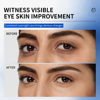 Sérum Contour des Yeux OEM GHK-Cu Peptide de Cuivre et Caféine en Roll-on – Anti-âge, Raffermissant, Éclaircissant, Répare Cernes, Poches et Rides