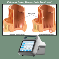 Appareil de chirurgie des hémorroïdes au laser 980 nm 1470 nm, dispositif de précision à intervention minimale, utilisé pour le traitement des fissures anales