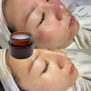 Crema Hidratante Reparadora de Barrera Facial EGF de Fábrica OEM, Alivio Calmante para la Piel Dañada, Reparación de Cicatrices, Gel Calmante con EGF - Product Image 1