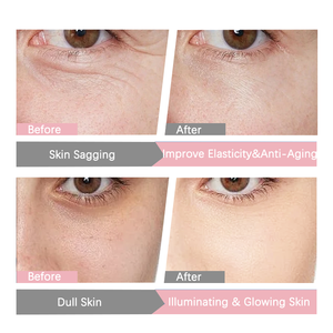 ครีมบำรุงผิวแบบเกาหลีสีชมพูพิ้นละอองน้ำบริสุทธิ์บริสุทธิ์สูง G ดูแลริ้วรอยบำรุงผิวแบบ<span class=keywords><strong>เกาหลี</strong></span> - Product Image 5