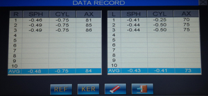 2025 оптические приборы, сенсорный экран, автоматический рефрактометр, кератометр, ручная фокусировка, запись данных - Product Image 3