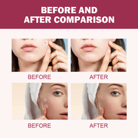 Patchs Détox Nuit Réparateurs Rapides pour le Visage avec Extrait de Centella Asiatica, Huile Essentielle d'Arbre à Thé et Acide Salicylique