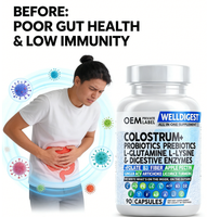 Cápsulas OEM Todo en Uno de Calostro + Probióticos y Prebióticos |   90 Cápsulas con Enzimas Digestivas para Apoyar el Bienestar Intestinal
