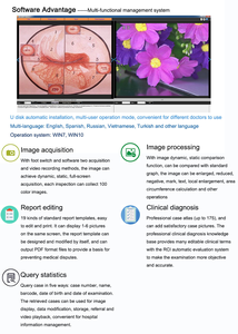 Microscope vidéo binoculaire à <span class=keywords><strong>filtre</strong></span> vert Full HD Kernel, colposcope optique gynécologique pour gynécologie, colposcopie <span class=keywords><strong>KN</strong></span>-2200B - Product Image 6