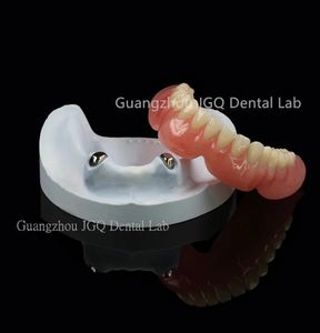 उच्च गुणवत्ता वाले व्यक्तिगत अनुकूलन पूर्ण-मुंह वाले डेबेंचर मुंह में बड़ी संख्या में लापता दांतों की मरम्मत - Product Image 2