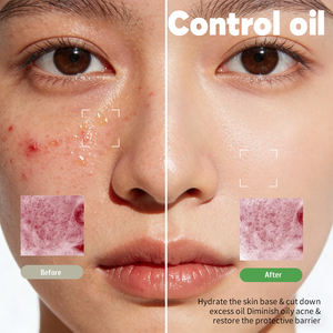 ओएम/ओडम मल्टी-अहा एक्सफोलिटिंग टोनर पैड | चिकनी और संतुलित त्वचा के लिए ग्लाइकोलिक + लैक्टिक एसिड कॉम्प्लेक्स, दैनिक उपयोग के लिए उपयुक्त - Product Image 4