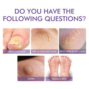 West Month 2 pares de mascarillas de lavanda para pies, para callos y durezas, hidratantes, que eliminan la piel muerta, kit de mascarillas para pies - Product Image 3