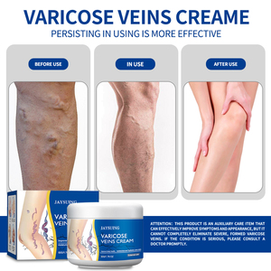 50g <strong>Varicose</strong> <strong>Veins</strong> Relief <strong>Cream</strong> Improve Varicosity, Soothe Acid Swelling &amp; Pain Moisturizing Body Care <strong>Cream</strong> for Daily Use - Product Image 5