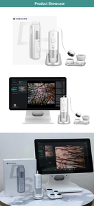 เครื่องวิเคราะห์หนังศีรษะแบบพกพาอัจฉริยะ AI วัสดุ ABS กล้องวิเคราะห์เส้นผม 50X 100X 200X ตรวจจับรูขุมขน - Product Image 6