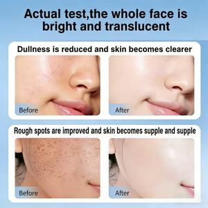 Sérum éclaircissant pour la peau 30 ml Niacinamide Acide kojique - Vente chaude Marque privée <span class=keywords><strong>Correcteur</strong></span> <span class=keywords><strong>de</strong></span> taches brunes pour tous les types <span class=keywords><strong>de</strong></span> peau Vente en gros - Product Image 4