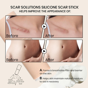 Balsamo Koec per Schiarire le Cicatrici, Nutre e Ripara la Pelle, Migliora l'Aspetto delle Cicatrici da Ustioni e Acne, Idratante e Ringiovanente - Product Image 4