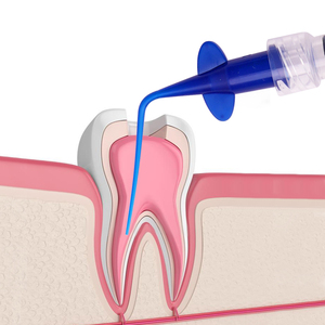 <span class=keywords><strong>Jeringa</strong></span> Dental Desechable con Punta <span class=keywords><strong>de</strong></span> Administración, Aguja Endodóntica, Aplicador para Conducto Radicular, Agujas para <span class=keywords><strong>Irrigación</strong></span> Periodontal - Product Image 6