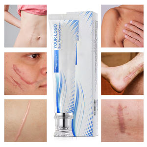 <strong>Scar</strong> Repair <strong>Cream</strong> Wholesale <strong>Scar</strong> Moisturizing Repair Organic <strong>Scar</strong> Removal All Skin Types <strong>Scar</strong> <strong>Cream</strong> For Adults - Product Image 4
