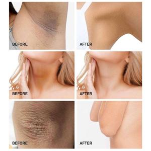 ครีมทารักแร้ดำ,ครีมทารักแร้หน้าขาวผิวสว่าง - Product Image 3