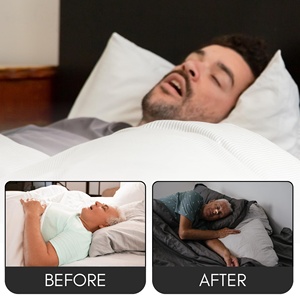 Tiras Nasales Hipoalergénicas y Resistentes al Sudor para Dormir, Sin Látex, Mejoran la Respiración, Detienen los Ronquidos, Cinta Nasal de Polietileno No Tejido - Product Image 2