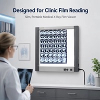 Visualiseur de films radiologiques LED à haute luminosité, anti-éblouissement, à intensité réglable, design fin, boîte de lecture de films médicaux pour usage clinique