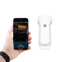 Sonda de Ultrasonido Portátil Inalámbrica WiFi USB con Matriz de Fase Lineal Convexa para Uso Humano y Veterinario