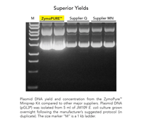 Kit de préparation de plasmides ZymoPURE pour l'extraction d'ADN de plasmides à haut rendement et sans endotoxines