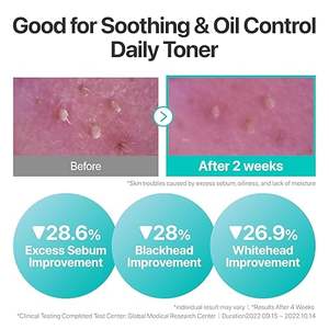 Tonique Apaisant aux Herbes Pure-Full N°1 - Tonique Visage Apaisant pour Peaux Sensibles à la Camomille et à la Centella Asiatica - Product Image 3