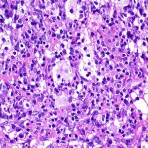 BestScope BS-2064T Microscope biologique trinoculaire haut de gamme avec éclairage Koehler pour l'enseignement en pathologie clinique - Product Image 6