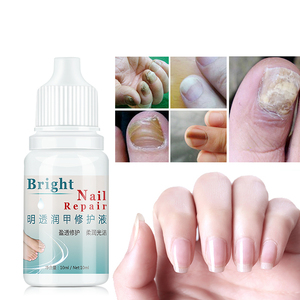 10ml onychomycose paronychie Anti-infection crème de traitement des ongles tue 99.9% bactéries champignon gel de soin des ongles fongiques - Product Image 3