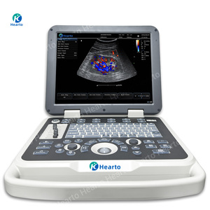 Escáner <span class=keywords><strong>de</strong></span> <span class=keywords><strong>Ultrasonido</strong></span> Doppler Color Portátil con Sonda Convexa Lineal para Obstetricia/Ginecología, <span class=keywords><strong>Abdomen</strong></span> y Vascular - Product Image 2