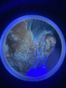 KN-9000B त्वचा विज्ञान लकड़ी का दीपक अल्ट्रासोनिक इलेक्ट्रॉनिक उपकरण चेहरे विश्लेषक त्वचा परीक्षण इलेक्ट्रिक मेडिकल जंगल लैंप फोन - Product Image 5