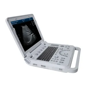 CONTEC CMS1700A renkli doppler kardiyak ultrason tarayıcı taşınabilir ultrason masa usg makinesi