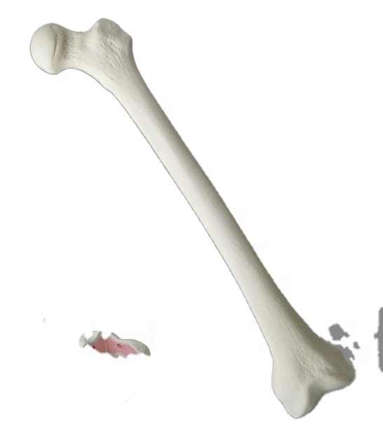 Medical Surgery Practice Human Femur Bone Model - Rongzhiyou