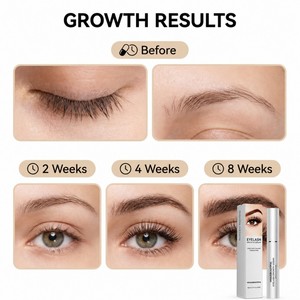 Venusbeautiful, sérum de croissance <span class=keywords><strong>des</strong></span> cils biologique en gros pour une extension naturelle <span class=keywords><strong>des</strong></span> cils, fabricant de logo personnalisé, OEM ODM - Product Image 4