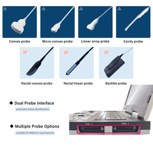 Mesin <span class=keywords><strong>Ultrasound</strong></span> medis, pemindai <span class=keywords><strong>Ultrasound</strong></span>/ultrasonografi diagnostik mesin <span class=keywords><strong>Ultrasound</strong></span> medis harga bagus - Product Image 5