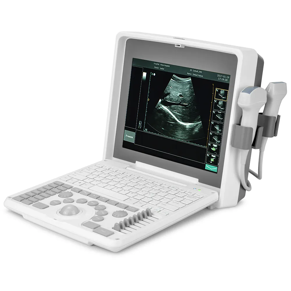 Ziekenhuis Diagnostische Apparatuur Laptop Escaner Ultrasonido Medische Veterinaire Draagbare B Echografie Machine