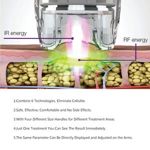 Máquina Profesional de Adelgazamiento Corporal con Vacumterapia y Radiofrecuencia Winkonlaser <span class=keywords><strong>para</strong></span> <span class=keywords><strong>Tratamiento</strong></span> de Drenaje Linfático <span class=keywords><strong>en</strong></span> Salón - Product Image 4