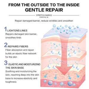 <span class=keywords><strong>Aceite</strong></span> Corporal Esencial <span class=keywords><strong>Regenerador</strong></span> para el Cuidado de la Piel FEXMS al por Mayor, Reparación de <span class=keywords><strong>Cicatrices</strong></span>, Prevención de Estrías, Eliminación de Estrías - Product Image 4