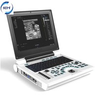 Appareil d'échographie portable et durable Rayman avec sonde convexe pour les cliniques vétérinaires (chien, chat, cheval, oiseau, chèvre)
