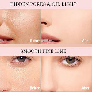 Private Label Shrinking Pores Repairing Facial Essence <b>Serum</b> Nicotinamide 5 in 1 Skin Care <b>Serum</b> - Product Image 5