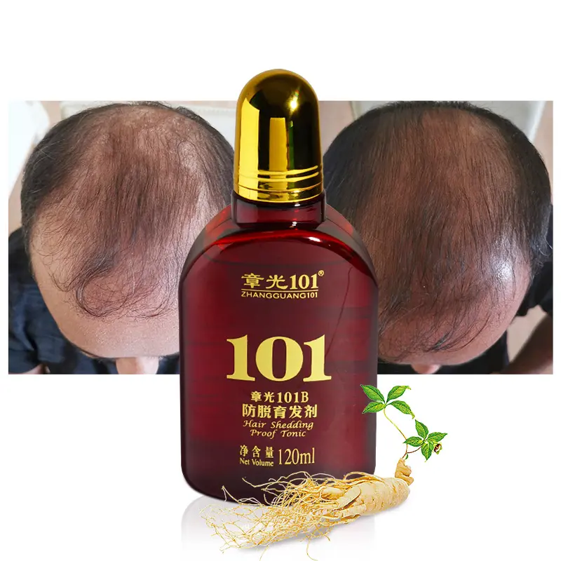 Best Selling Private Label Herbal Anti Hair Loss Serum Nourishing Scalp Formula for Damaged Hair