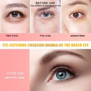 Patch Gel Anti-rides pour les Yeux Papillon Bicolore au Collagène et Vitamine E, Soin Visage Spa, Or 24K, Végétalien, Vitamine C en Feuille - Product Image 2