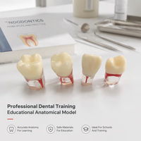 Modèle dentaire endodontique Red Roots pour la pratique des soins endodontiques