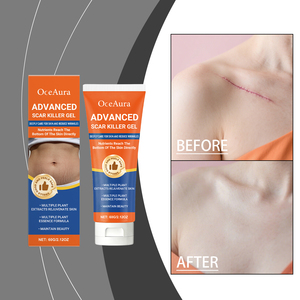 Crema para Eliminar Estrías de Forma Permanente, Crema para Mujeres Embarazadas, Crema Antiarrugas para el Embarazo, Crema Reafirmante para la Piel del Cuerpo - Product Image 2