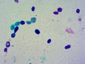 Lames de microbiologie médicale Lames de microscope 50 pièces Lames éducatives préparées Éducation de microbiologie médicale - Product Image 5