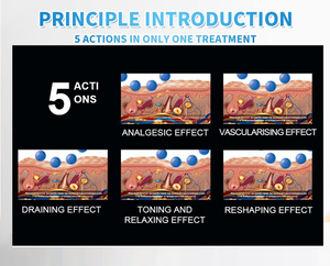 เครื่องนวดอีนโดสเฟียร์ขายดีอันดับต้นๆ สำหรับลดน้ำหนักและฟื้นฟูผิวหน้า พร้อมลูกกลิ้งความเร็วสูง 180,000 รอบต่อนาที สำหรับกระชับสัดส่วน ได้รับเครื่องหมาย CE - Product Image 4