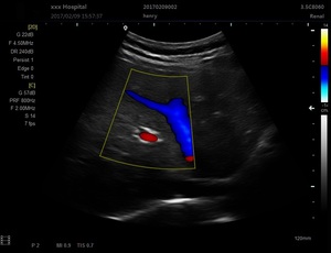 Laptop 3D <strong>4D</strong> Ultrasound Scanner Digital Color Doppler Echo Ultrasound Diagnostic Echocardiography <strong>Machine</strong> - Product Image 5