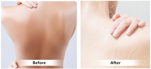 Crème éclaircissante et blanchissante pour la peau du vagin, pour le traitement des peaux noires - Product Image 4