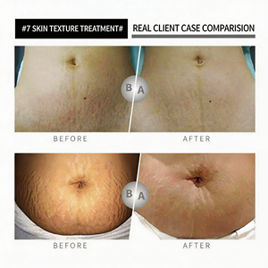 Etiqueta Privada OEM Personalizada, Loción de Esencia de Proteínas 7 en 1, Reparación de Estrías, Loción Corporal Hidratante y Humectante - Product Image 4